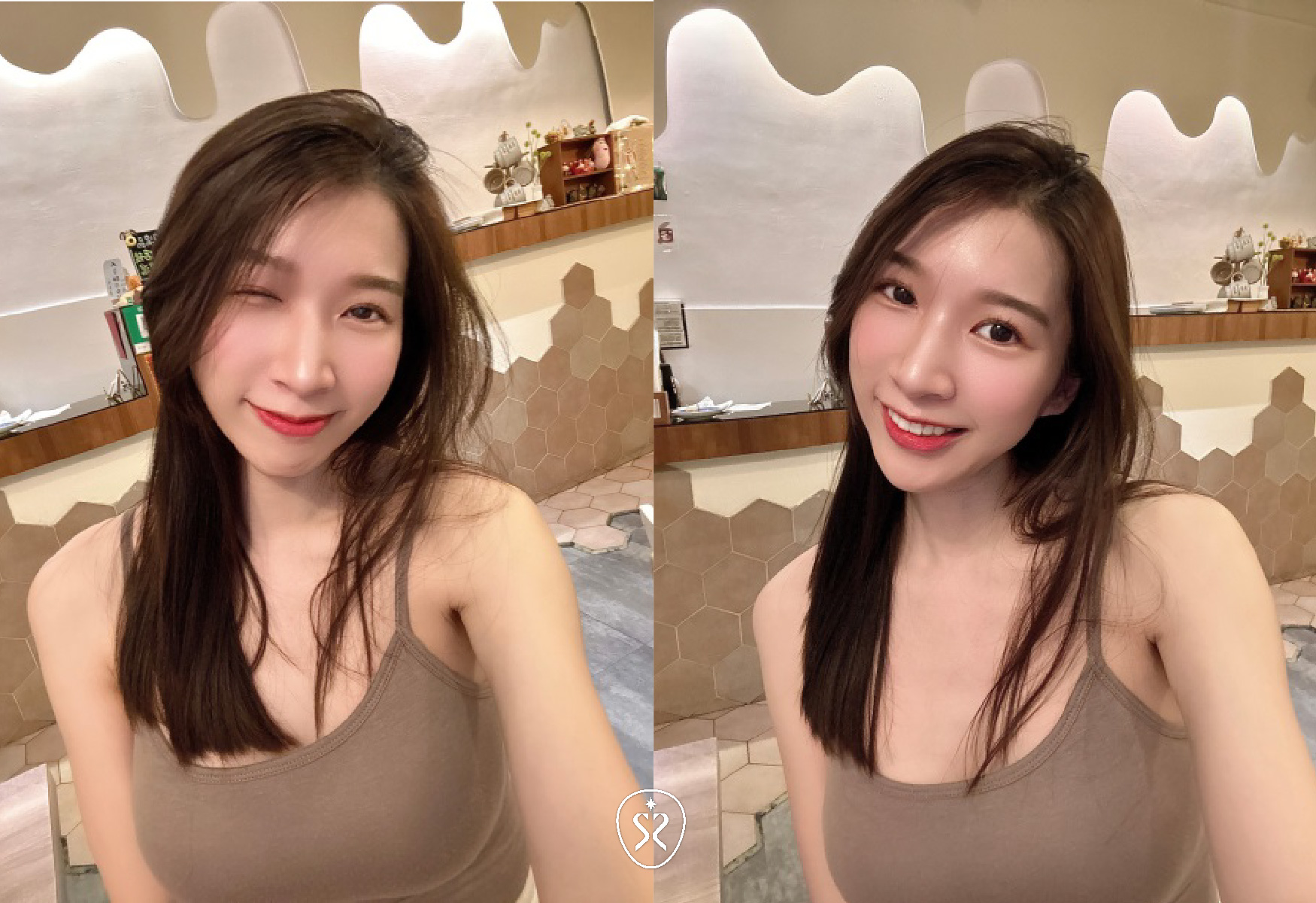 【肉毒除皺】
